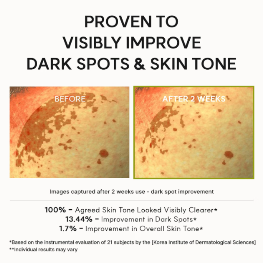 Arencia Vitamin C Booster Shot Serum with 5% Dual Vitamin C + Glutathione For Dark Spot Care