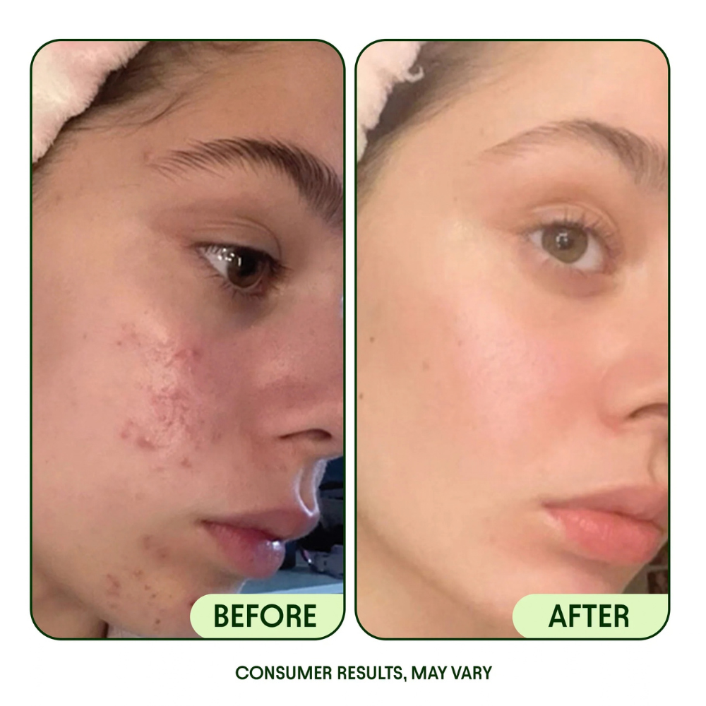 JIYU Facial Toning Pads with Peptides & Centella for Smooth & Hydrated Skin - 100 Pads Pack